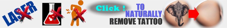 Tattoo Removal